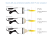 INTELECT FOCAL SHOCKWAVE SET - CHATTANOOGA paveikslėlis